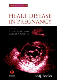 Heart Disease in Pregnancy Second edition
