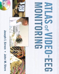 Image of Atlas Of Videi-EEG Monitoring