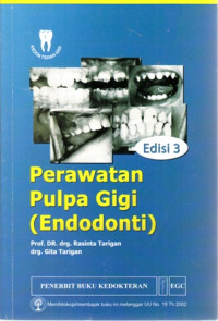 Perawatan Pulpa Gigi (Endodonti)