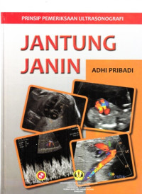 Prinsip Pemeriksaan Ultrasonografi Jantung janin