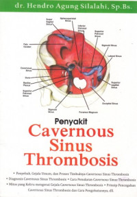 Image of Penyakit Cavernous Sinus Thrombosis